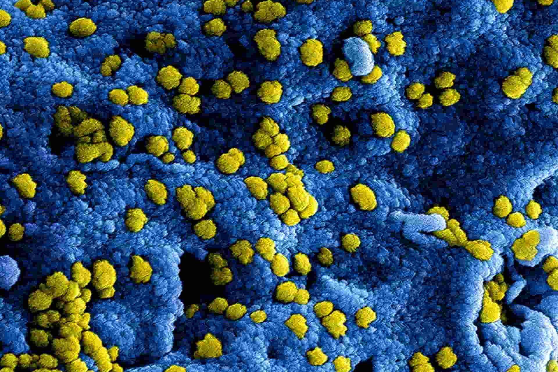 Proyectos en prevención